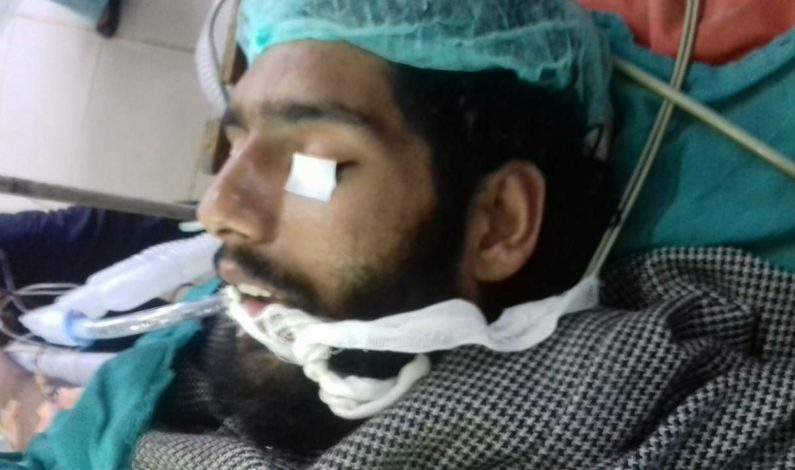 Militant injured critically in Pulwama gunfight admitted in SMHS hospital: Police Militant injured critically in Pulwama gunfight admitted in SMHS hospital: Police