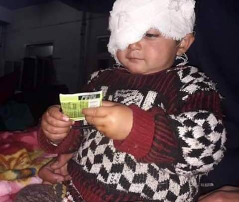 After forces fire pellets at little girl Hiba, Govt provides one lakh Rupees assistance for her eye treatment