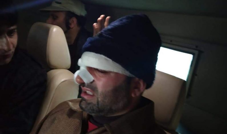 Deputy Mayor injured in assault during councillor’s session, hospitalized Deputy Mayor injured in assault during councillor’s session, hospitalized