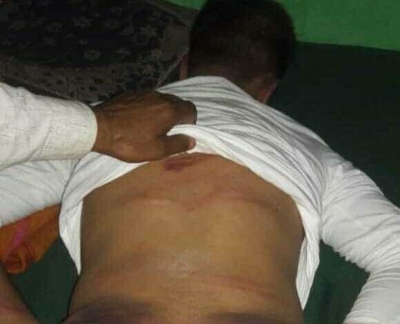 IAS aspirant allegedly beaten by forces’ in Pulwama IAS aspirant allegedly beaten by forces’ in Pulwama