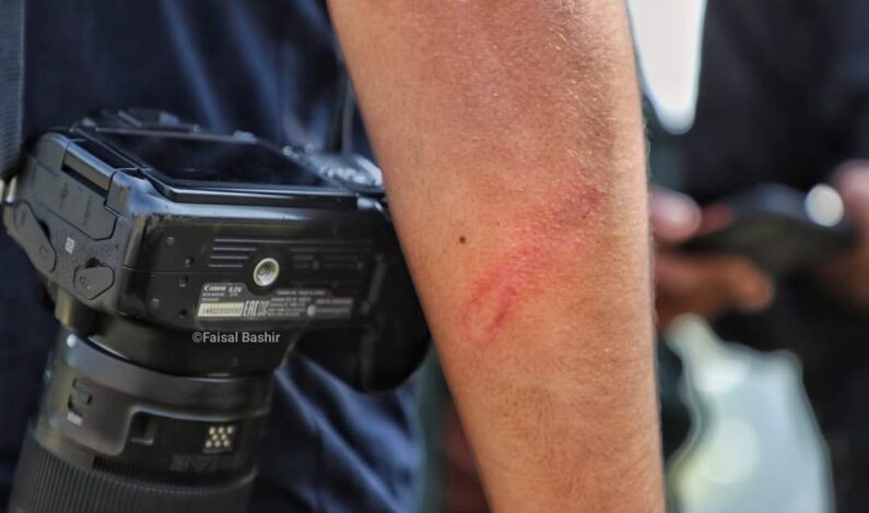 Three journalists allegedly beaten by Forces near encounter site in Pulwama Three journalists allegedly beaten by Forces near encounter site in Pulwama