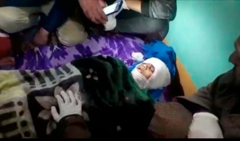 8-yr-old boy mauled to death by street dogs in Pulwama 8-yr-old boy mauled to death by street dogs in Pulwama