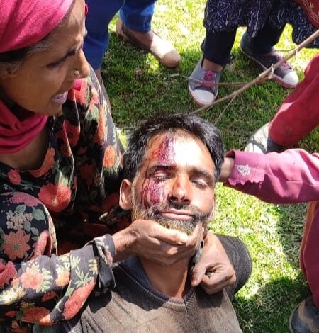 18 persons including five journalists injured as forest eviction drive turns violent in Shopian 18 persons including five journalists injured as forest eviction drive turns violent in Shopian