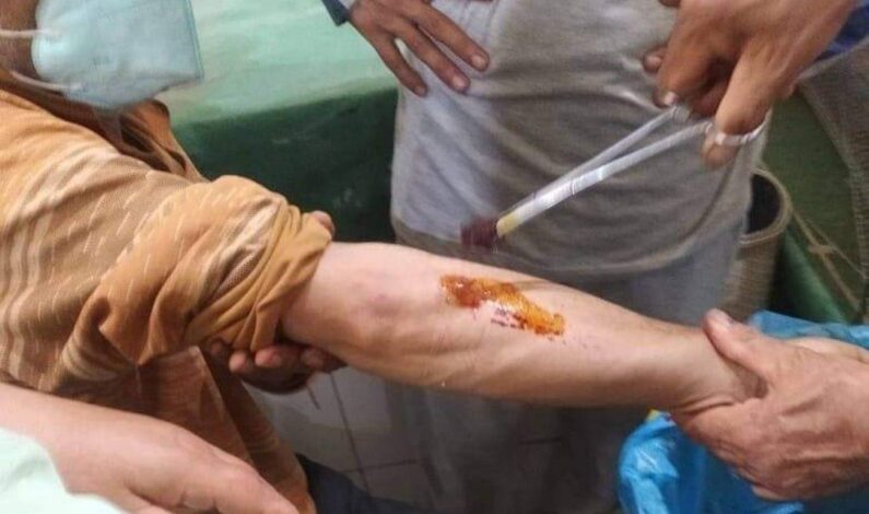 One among seven injured in grenade explosion in Tral shifted to Srinagar One among seven injured in grenade explosion in Tral shifted to Srinagar