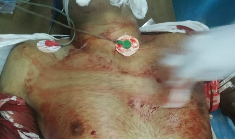 Unknown gunmen fire at 25-year-old youth in Srinagar Unknown gunmen fire at 25-year-old youth in Srinagar