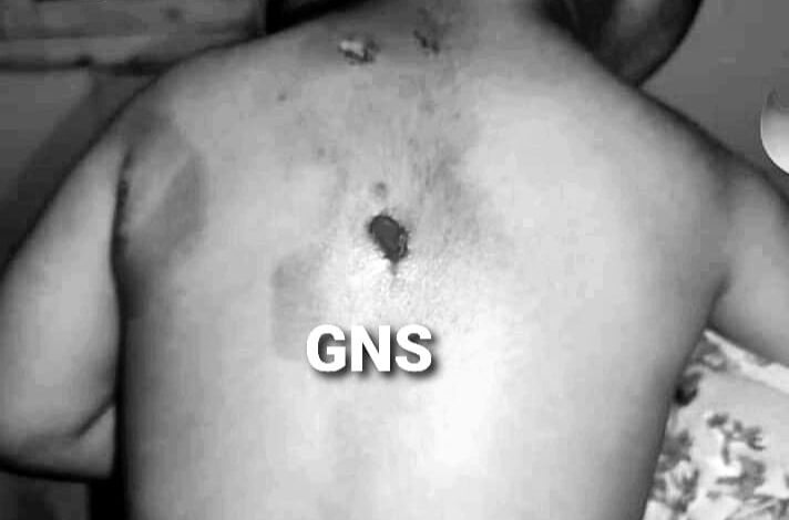 Bandipora: 4 year old Boy ‘Severely’ Wounded In Leopard Attack Bandipora: 4 year old Boy ‘Severely’ Wounded In Leopard Attack
