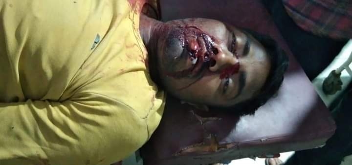 Non-Local Labourer Shot Dead In Kulgam Non-Local Labourer Shot Dead In Kulgam