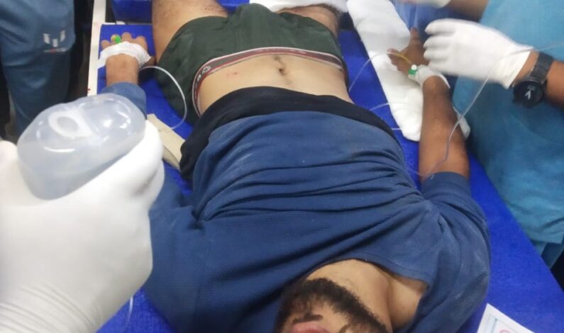 Civilian sustain bullet injury in North Kashmir’s Baramulla Civilian sustain bullet injury in North Kashmir’s Baramulla