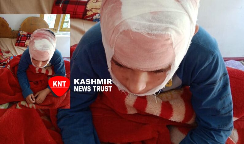 Beaten up by teacher class 5 student receives four stitches on head in Kashmir Beaten up by teacher class 5 student receives four stitches on head in Kashmir